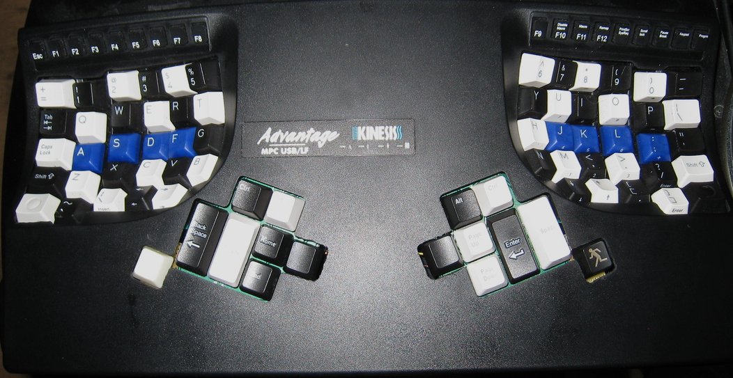 kinesis_6_extra_keys.jpg