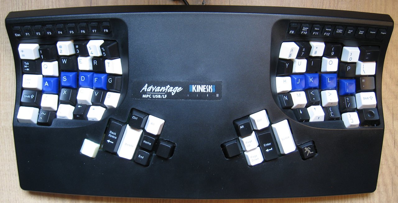 kinesis_6_extra_switches.jpg